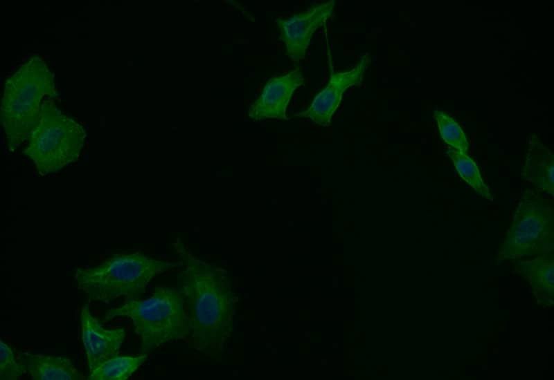 Immunocytochemistry/Immunofluorescence: CD44 Antibody (19H12) [NBP3-26680] - Staining of Hela with CD44 Antibody (19H12) at 1:25, counter-stained with DAPI. The cells were fixed in 4% formaldehyde and blocked in 10% normal Goat Serum. The cells were then incubated with the antibody overnight at 4C. The secondary antibody was Alexa Fluor 515-conjugated Goat Anti-Rabbit IgG (H+L).