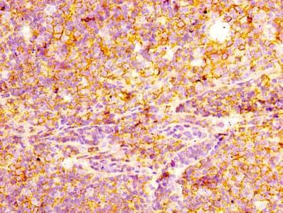 Immunohistochemistry: CD44 Antibody (4B7) [NBP3-26681] - Image of CD44 Antibody (4B7) diluted at 1:100 and staining in paraffin-embedded human tonsil tissue performed. After dewaxing and hydration, antigen retrieval was mediated by high pressure in a citrate buffer (pH 6.0). Section was blocked with 10% normal goat serum 30min at RT. Then primary antibody (1% BSA) was incubated at 4C overnight. The primary is detected by a biotinylated secondary antibody and visualized using an HRP conjugated SP system.