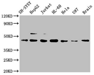 Western Blot: CCR9 Antibody (4G2) [NBP3-26685] - Positive Western Blot detected in: SH-SY5Y whole cell lysate, HepG2 whole cell lysate, Jurkat whole cell lysate, HL-60 whole cell lysate, Hela whole cell lysate, U87 whole cell lysate, Mouse brain tissue. All lanes: CCR9 Antibody at 1ug/ml. Secondary: Goat polyclonal to rabbit IgG at 1/50000 dilution. Predicted band size: 43, 41 KDa Observed band size: 43 KDa