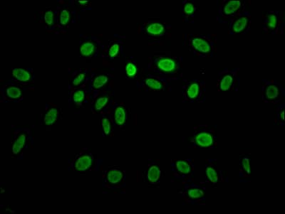 Immunocytochemistry/Immunofluorescence: Cyclin E1 Antibody (3A5) [NBP3-26692] - Staining of Hela Cells with Cyclin E1 Antibody (3A5) at 1:50, counter-stained with DAPI. The cells were fixed in 4% formaldehyde, permeated by 0.2% Triton X-100, and blocked in 10% normal Goat Serum. The cells were then incubated with the antibody overnight at 4C. Nuclear DNA was labeled in blue with DAPI. The secondary antibody was FITC-conjugated Goat Anti-Rabbit IgG (H+L).