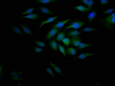 Immunocytochemistry/Immunofluorescence: Cyclin E1 Antibody (9H12) [NBP3-26693] - Staining of Hela Cells with Cyclin E1 Antibody (9H12) at 1:50, counter-stained with DAPI. The cells were fixed in 4% formaldehyde, permeated by 0.2% Triton X-100, and blocked in 10% normal Goat Serum. The cells were then incubated with the antibody overnight at 4C. Nuclear DNA was labeled in blue with DAPI. The secondary antibody was FITC-conjugated Goat Anti-Rabbit IgG (H+L).