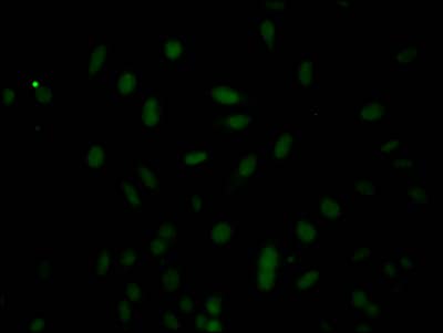 Immunocytochemistry/Immunofluorescence: Caspase-3 Antibody (5B2) - Pro [NBP3-26699] - Staining of Hela Cells with Caspase-3 Antibody (5B2) - Pro at 1:50, counter-stained with DAPI. The cells were fixed in 4% formaldehyde, permeated by 0.2% Triton X-100, and blocked in 10% normal Goat Serum. The cells were then incubated with the antibody overnight at 4C. Nuclear DNA was labeled in blue with DAPI. The secondary antibody was FITC-conjugated Goat Anti-Rabbit IgG (H+L).