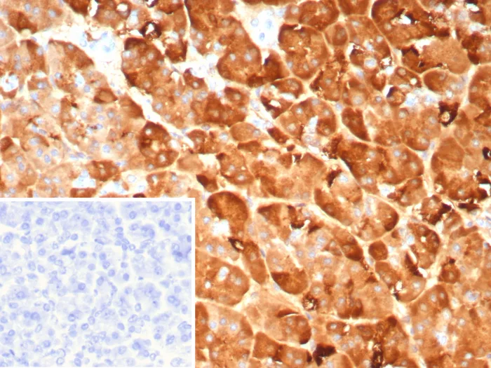 Formalin-fixed, paraffin-embedded human pancreas stained with Pancreatic Lipase Antibody (PNLIP/9041). Inset: PBS instead of primary antibody; secondary only negative control.