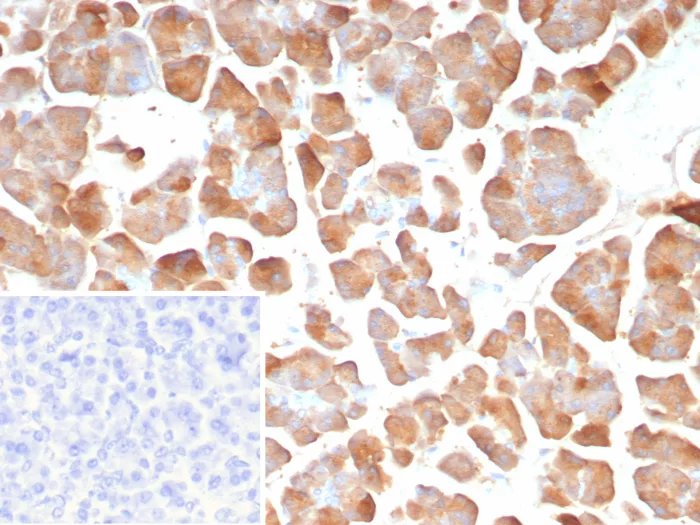 Formalin-fixed, paraffin-embedded human pancreas stained with Pancreatic Lipase Antibody (PNLIP/8913). Inset: PBS instead of primary antibody; secondary only negative control.