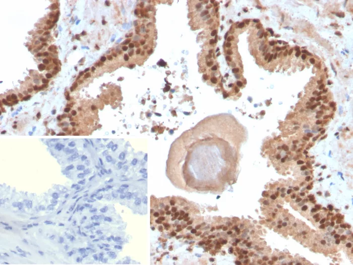 Formalin-fixed, paraffin-embedded human skin stained with SOX18 Antibody (SOX18/3271). Inset: PBS instead of primary antibody; secondary only negative control.