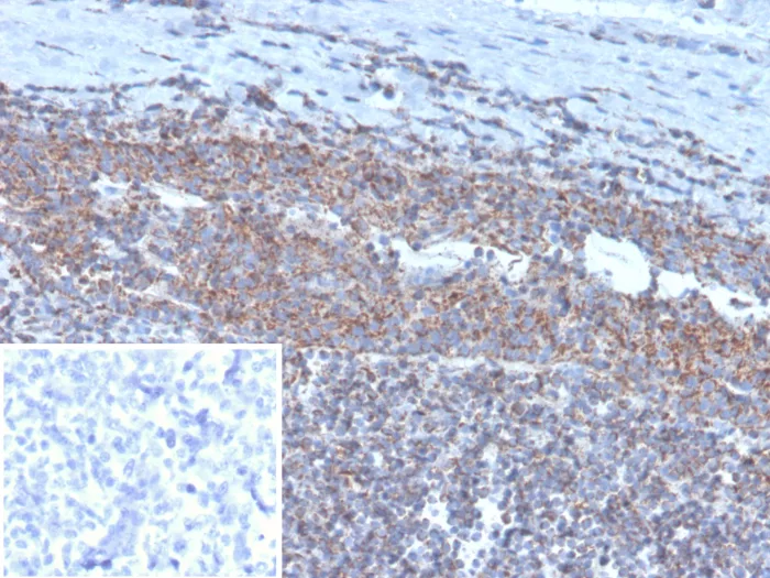 Formalin-fixed, paraffin-embedded human tonsil stained with BCOR Antibody (BCOR/1311). Inset: PBS instead of primary antibody; secondary only negative control.