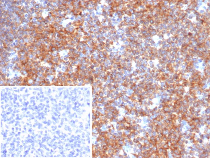 Formalin-fixed, paraffin-embedded human tonsil stained with BCOR Antibody (BCOR/2372). Inset: PBS instead of primary antibody; secondary only negative control.