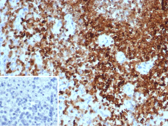 Formalin-fixed, paraffin-embedded human spleen stained with SHP-1 Antibody (PTPN6/7543). Inset: PBS instead of primary antibody; secondary only negative control.