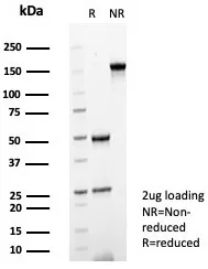 Formalin-fixed, paraffin-embedded human tonsil stained with SHP-1 Antibody (PTPN6/7544). Inset: PBS instead of primary antibody; secondary only negative control.