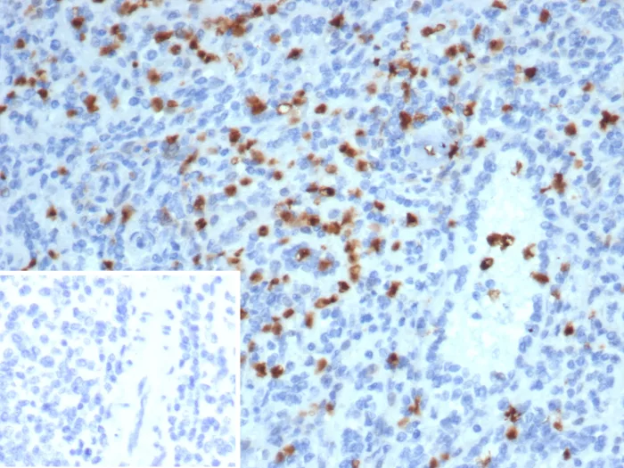 Formalin-fixed, paraffin-embedded human spleen stained with S100A13 Antibody (S100A13/7482). Inset: PBS instead of primary antibody; secondary only negative control.