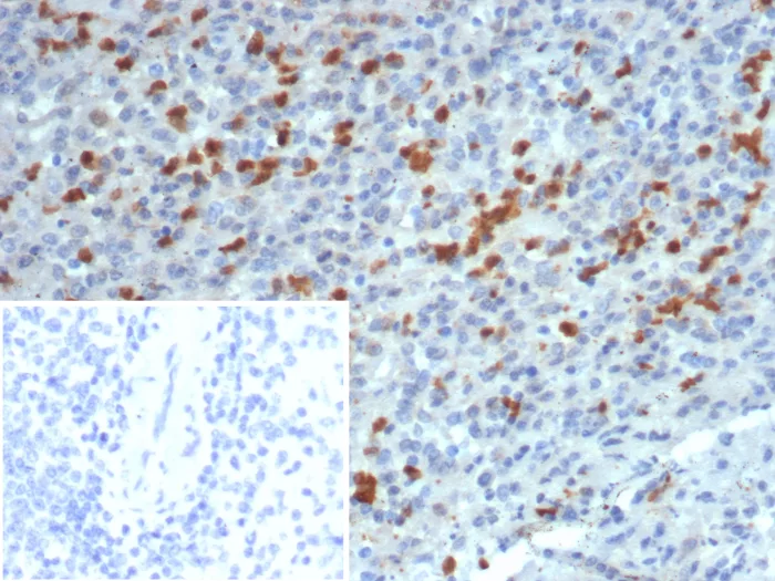 Formalin-fixed, paraffin-embedded human spleen stained with S100A13 Antibody (S100A13/7483). Inset: PBS instead of primary antibody; secondary only negative control.