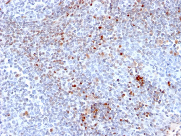 Formalin-fixed, paraffin-embedded human tonsil stained with SATB1 Antibody (SATB1/2661).