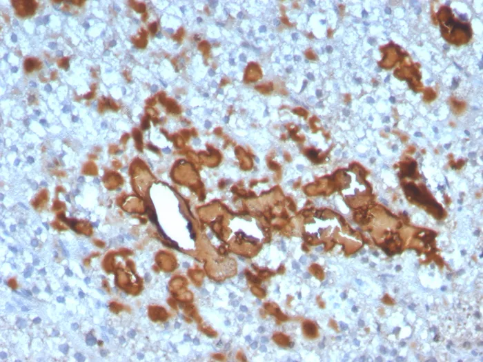 Analysis of Protein Array containing more than 19,000 full-length human proteins using CCL23-Monospecific Mouse Monoclonal Antibody (CCL23/4034). 