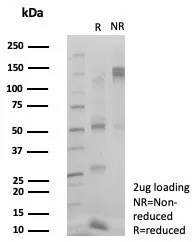 Flow cytometric analysis of PFA-fixed HeLa cells.ZSCAN5 Antibody (PCRP-ZSCAN5A-2H4) followed by goat anti-mouse IgG-CF488 (blue), unstained cells (red).