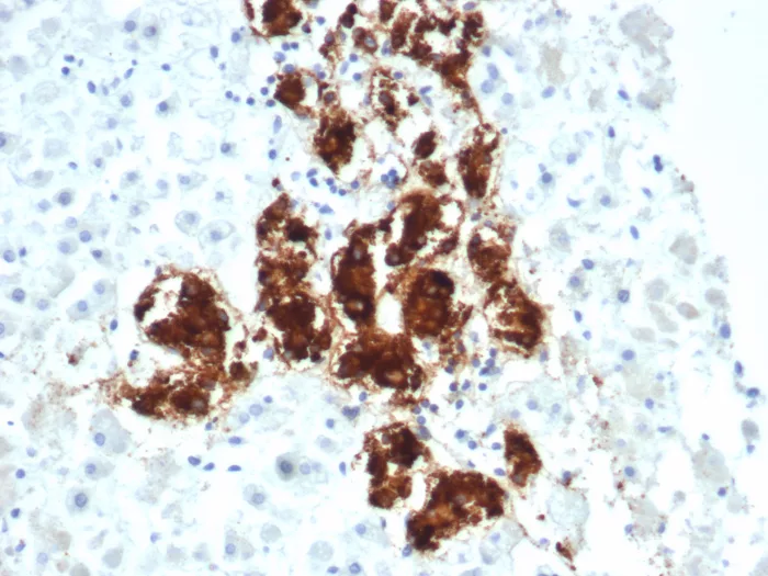 Formalin-fixed, paraffin-embedded human adrenal gland stained with Dopamine beta-Hydroxylase Antibody (DBH/7222). HIER: Tris/EDTA, pH9.0, 45min. 2°C: HRP-polymer, 30min. DAB, 5min.