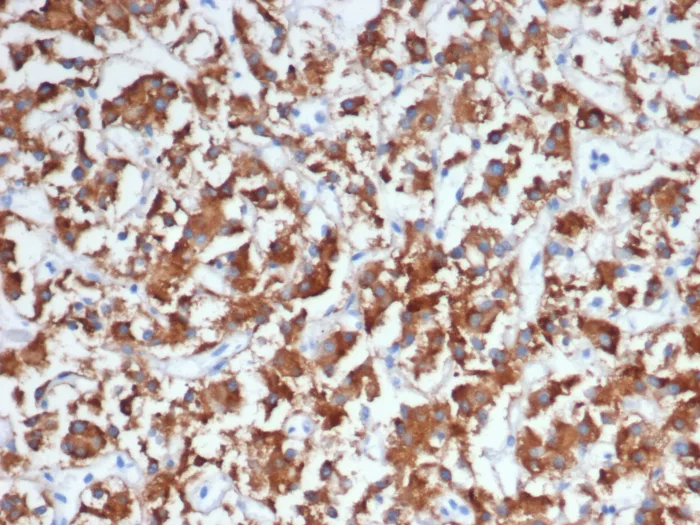 Formalin-fixed, paraffin-embedded human adrenal gland stained with Dopamine beta-Hydroxylase Antibody (DBH/7224). HIER: Tris/EDTA, pH9.0, 45min. 2°C: HRP-polymer, 30min. DAB, 5min.