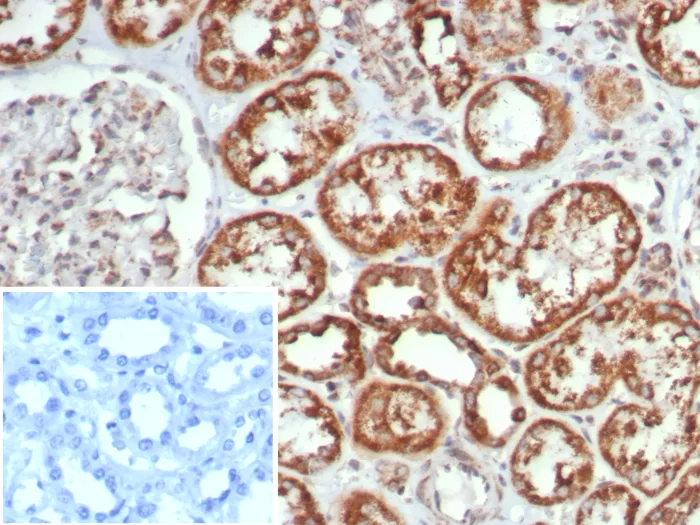 Formalin-fixed, paraffin-embedded human kidney stained with MR1 Antibody (MR1/7579). Inset: PBS instead of primary antibody; secondary only negative control.