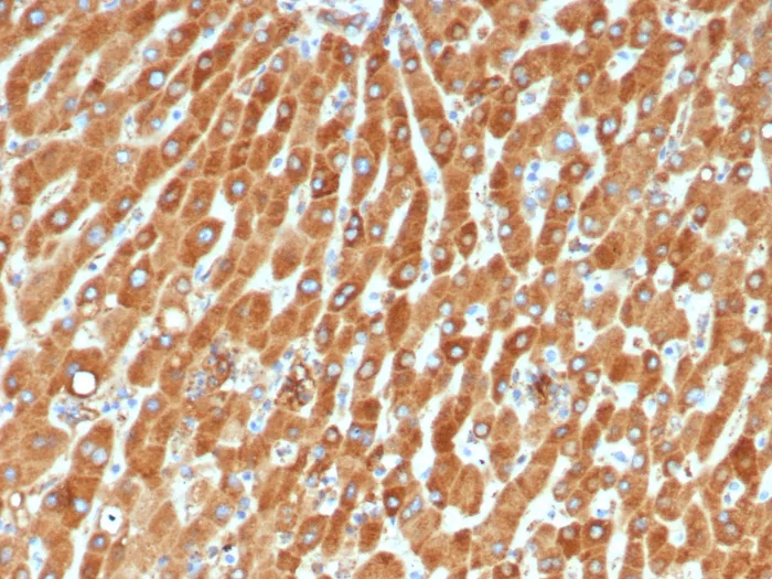 Formalin-fixed, paraffin-embedded human liver stained with Haptoglobin Antibody (HP/4815). HIER: Tris/EDTA, pH9.0, 45min. 2°C: HRP-polymer, 30min. DAB, 5min.