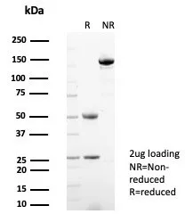 Formalin-fixed, paraffin-embedded human spleen stained with HSP90 alpha Antibody (HSP90AA1/7426). Inset: PBS instead of primary antibody; secondary only negative control.