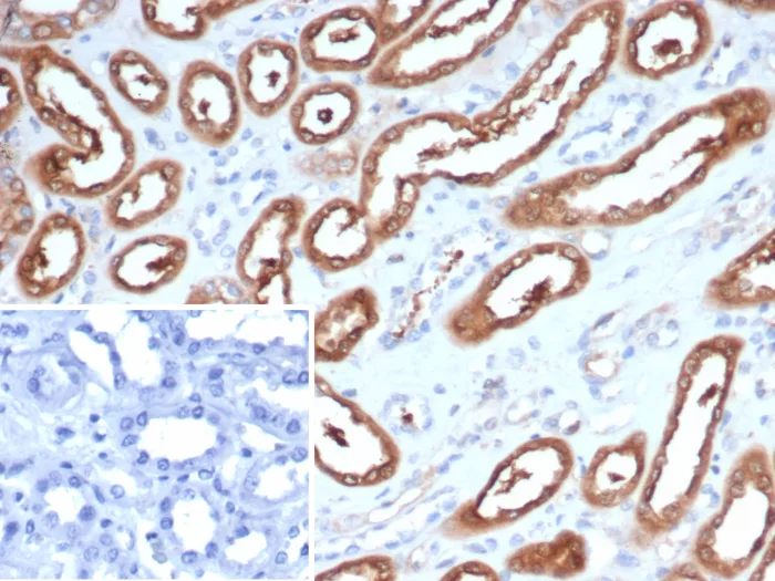 Formalin-fixed, paraffin-embedded human kidney stained with NM23-H2/NME2 Antibody (NME2/6437). Inset: PBS instead of primary antibody; secondary only negative control.