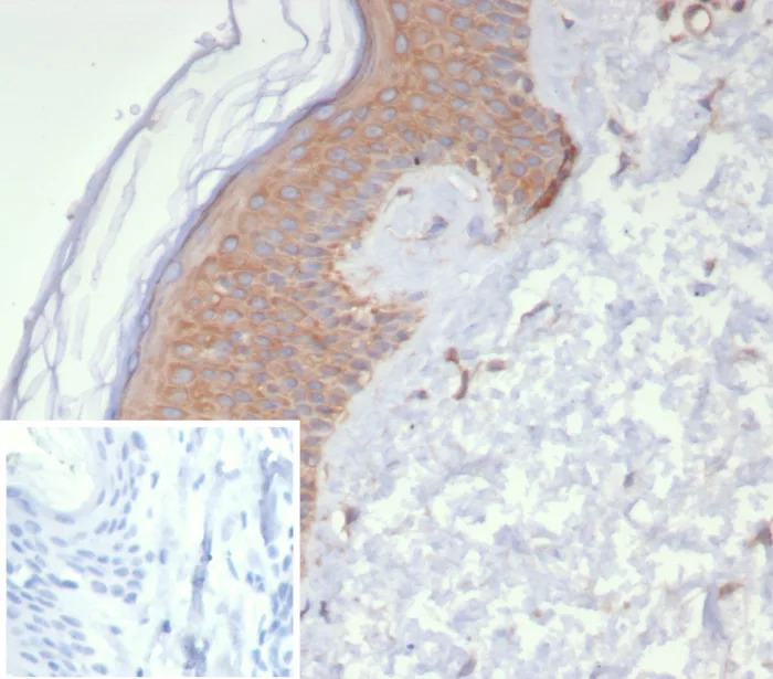 Formalin-fixed, paraffin-embedded human skin stained with NM23-H2/NME2 Antibody (NME2/6437). Inset: PBS instead of primary antibody; secondary only negative control.
