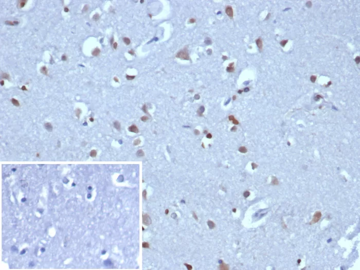 Formalin-fixed, paraffin-embedded human tonsil stained with Neurogenin-3 Antibody (NGN3/1808) HIER: Tris/EDTA, pH9.0, 45min. 2°C: HRP-polymer, 30min. DAB, 5min.