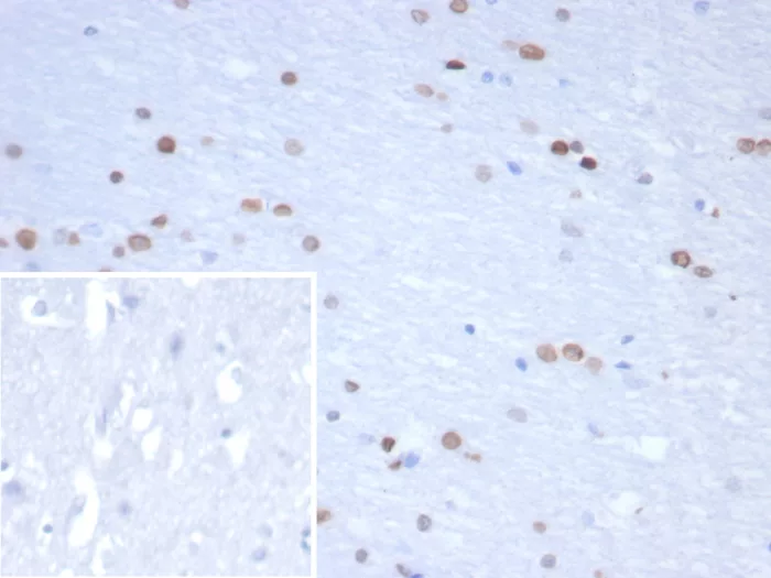 Formalin-fixed, paraffin-embedded human brain stained with Neurogenin-3 Antibody (NGN3/1809) HIER: Tris/EDTA, pH9.0, 45min. 2°C: HRP-polymer, 30min. DAB, 5min.