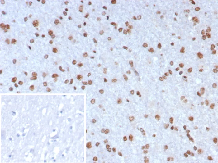 Formalin-fixed, paraffin-embedded human brain stained with Neurogenin-3 Antibody (NGN3/7698). Inset: PBS instead of primary antibody; secondary only negative control.