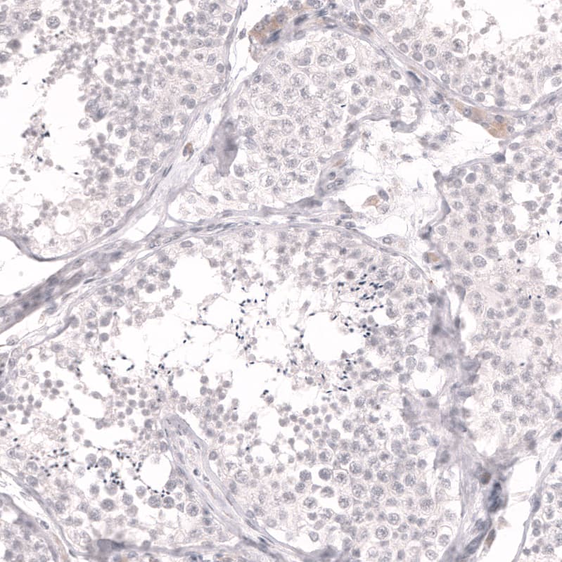 Staining of human testis shows no positivity in cells in seminiferous ducts as expected.