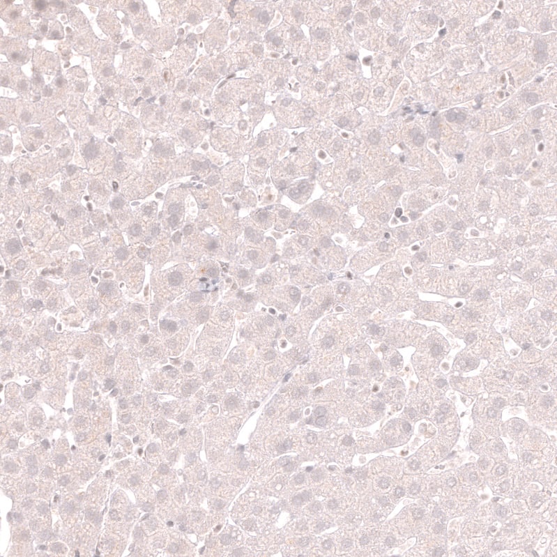 Staining of human liver shows no positivity in hepatocytes as expected.