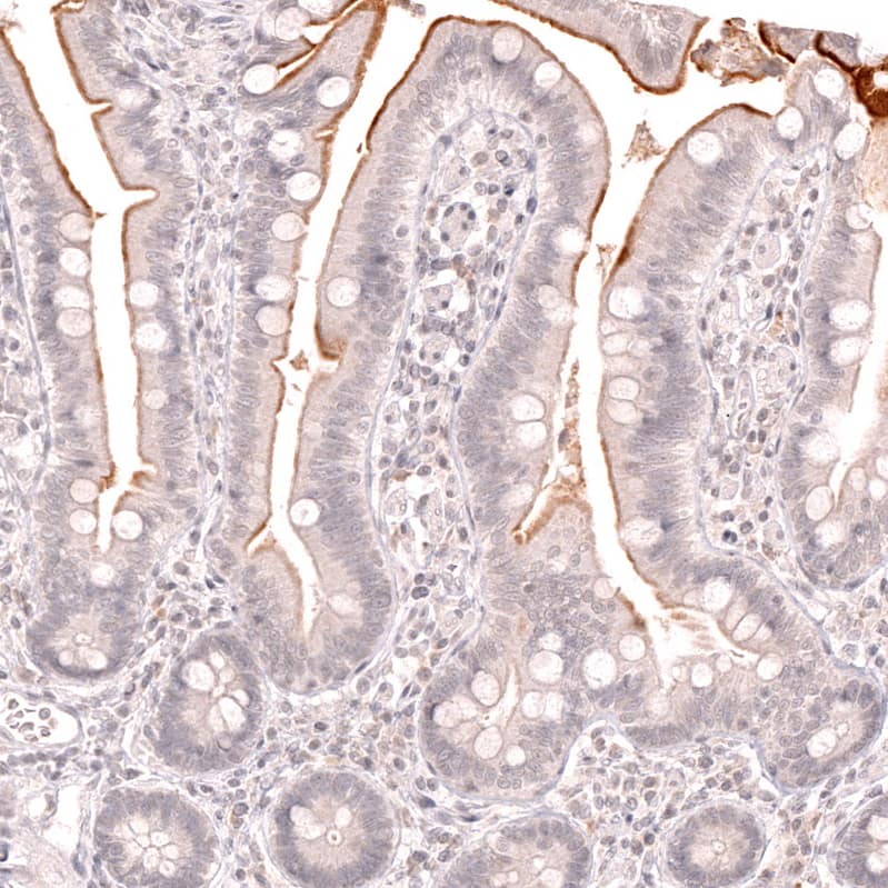 Staining of human small intestine shows moderate membranous positivity in the intestinal brush border.