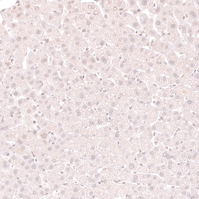 Staining of human liver shows no positivity in hepatocytes as expected.