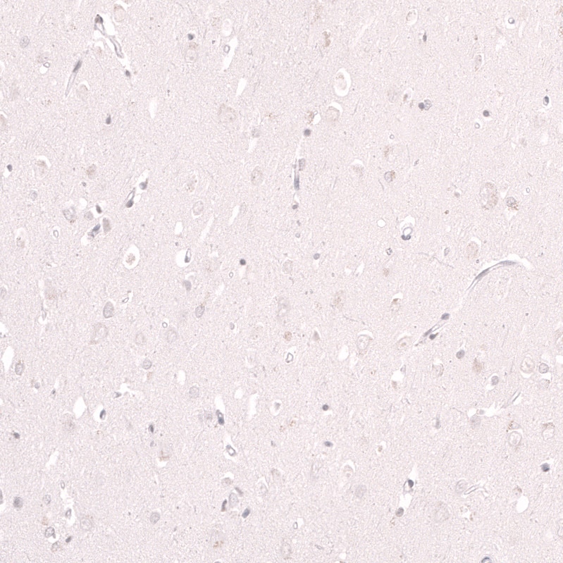 Immunohistochemistry-Paraffin Lactase Antibody (CL14133)