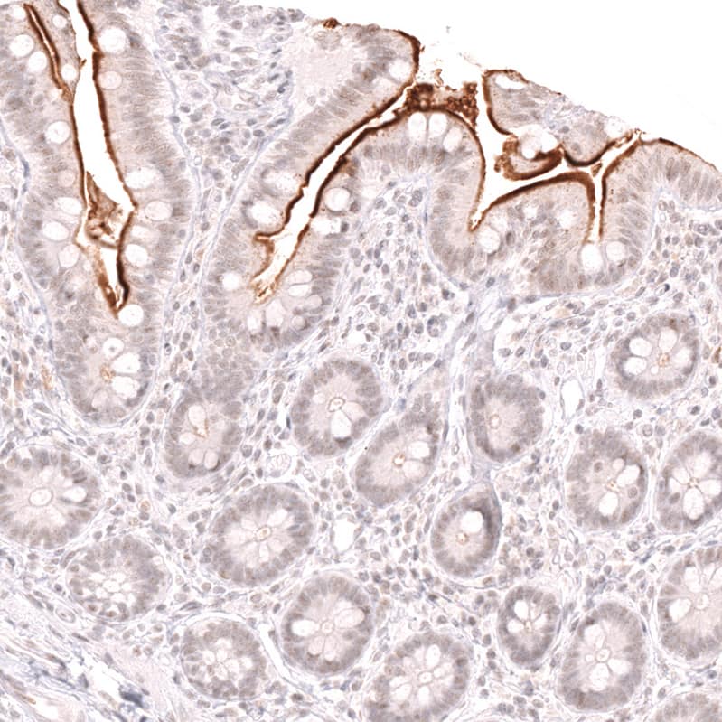 Staining of human small intestine shows strong membranous positivity in the intestinal brush border.