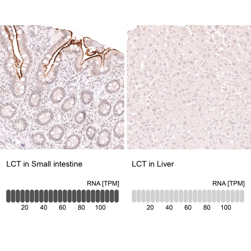 Analysis in human small intestine and liver tissues. Corresponding RNA-seq data are presented for the same tissues.