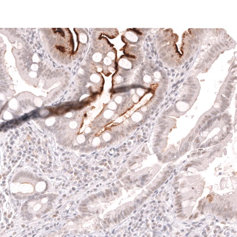 Staining of human duodenum shows strong membranous positivity in the intestinal brush border.