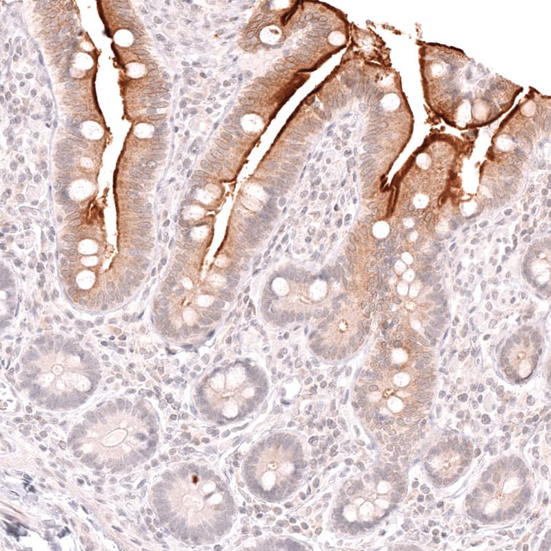 Staining of human small intestine shows strong membranous positivity in the intestinal brush border.