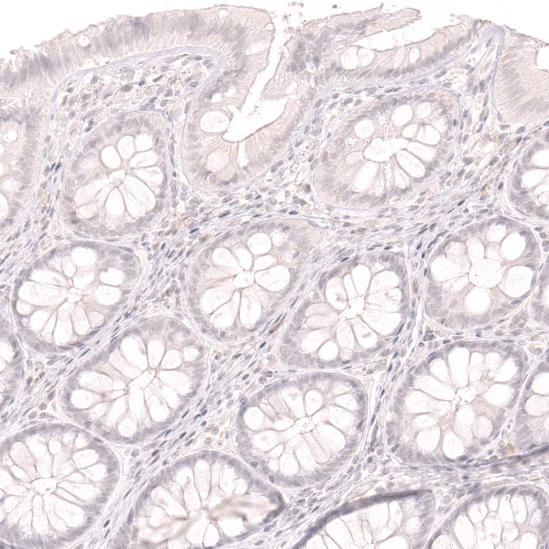 <b>Orthogonal Strategies Validation. </b>Staining of human colon shows no positivity in glandular cells as expected.