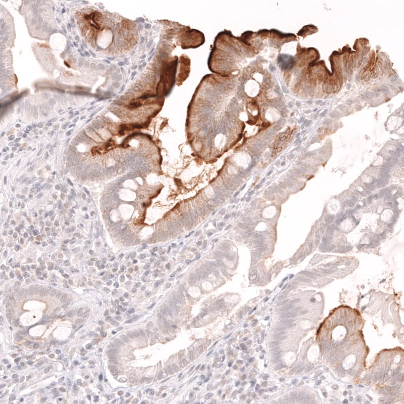 Staining of human duodenum shows strong membranous positivity in the intestinal brush border.