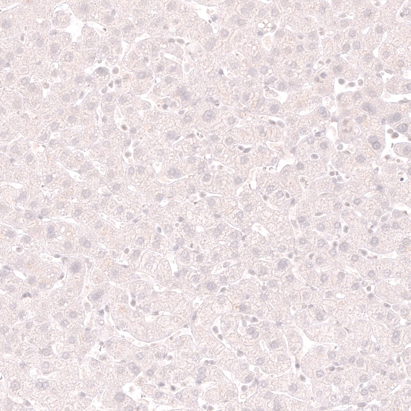 Staining of human liver shows no positivity in hepatocytes as expected.