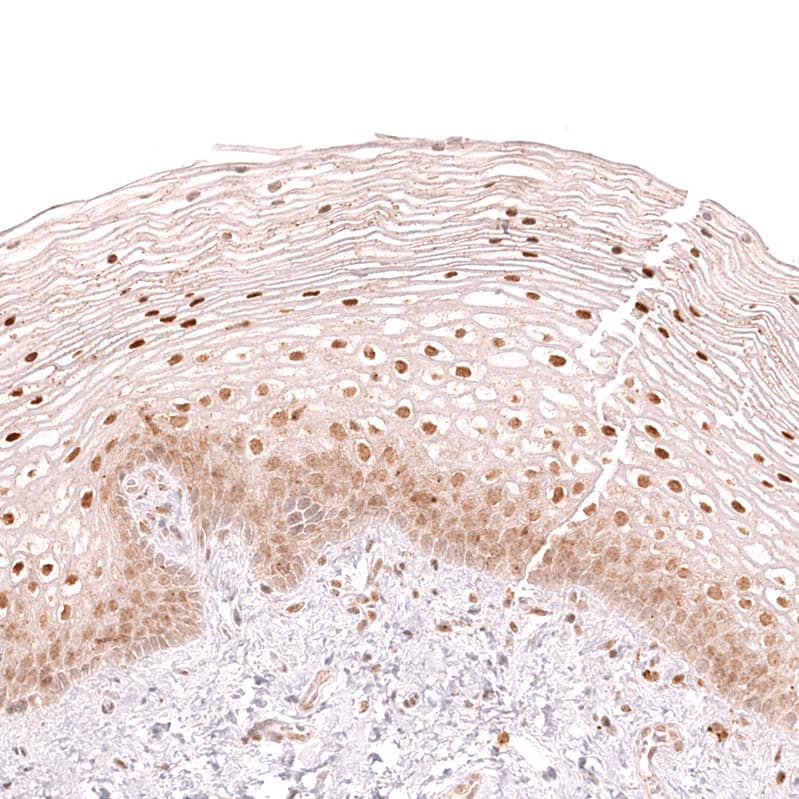 Staining of human cervix shows moderate nuclear positivity in squamous epithelial cells.