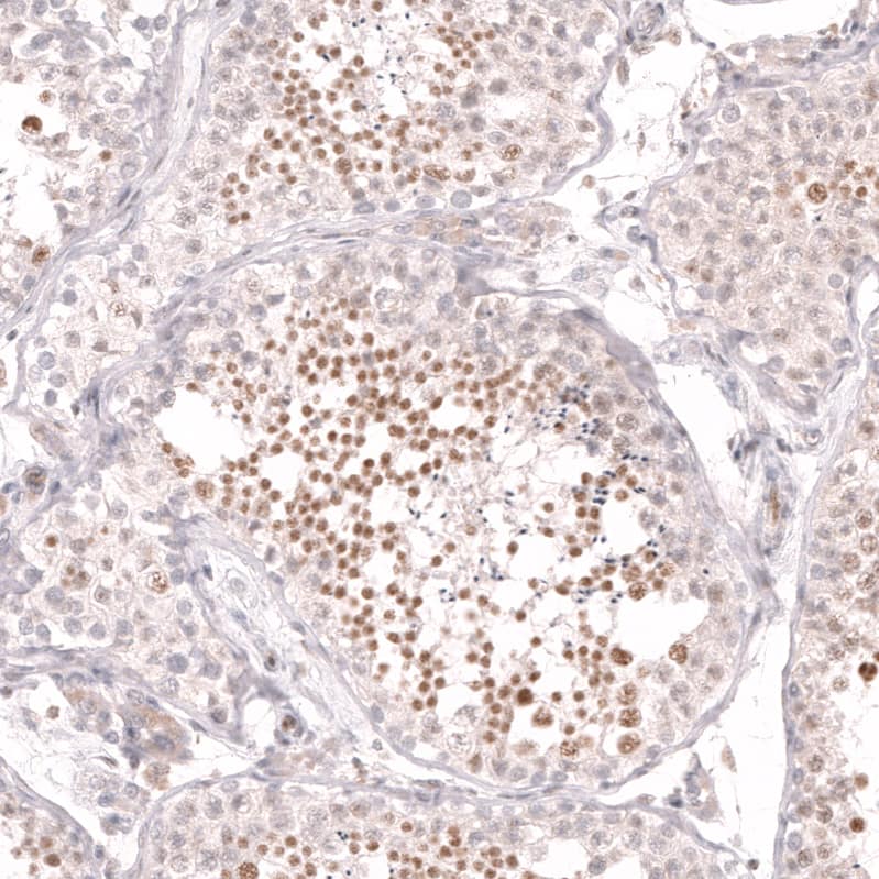 Staining of human testis shows strong nuclear positivity in spermatids.