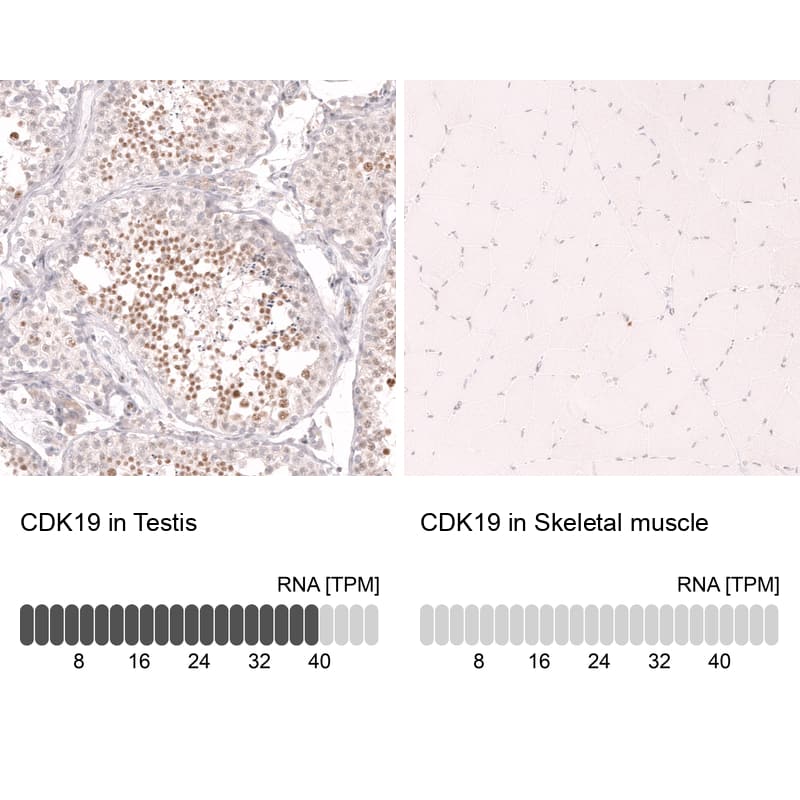 Analysis in human testis and skeletal muscle tissues. Corresponding RNA-seq data are presented for the same tissues.