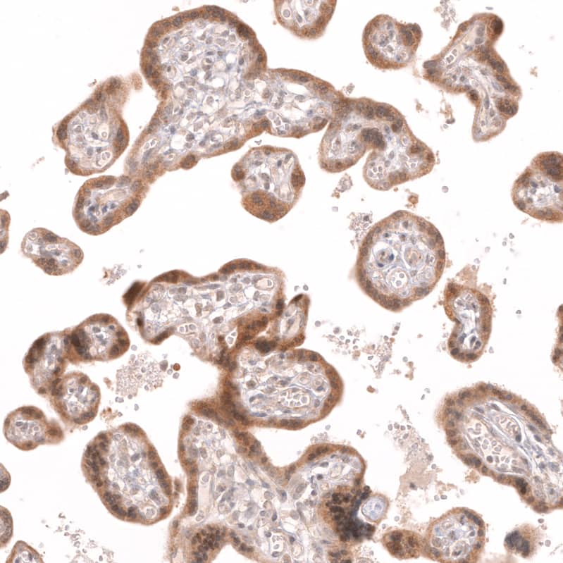 Staining of human placenta shows moderate cytoplasmic positivity in trophoblastic cells.