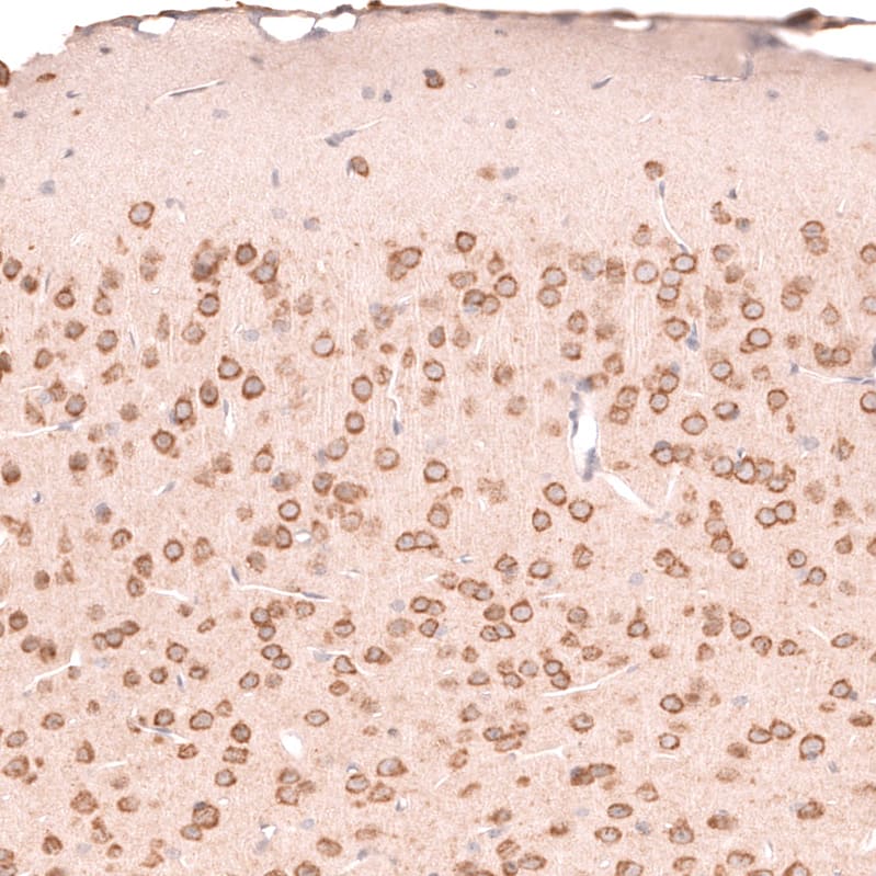 Staining of mouse brain shows moderate to strong cytoplasmic positivity in neurons.