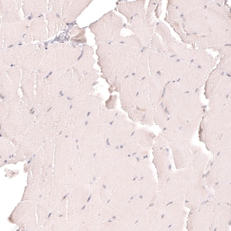Staining of human skeletal muscle shows no positivity in myocytes as expected.
