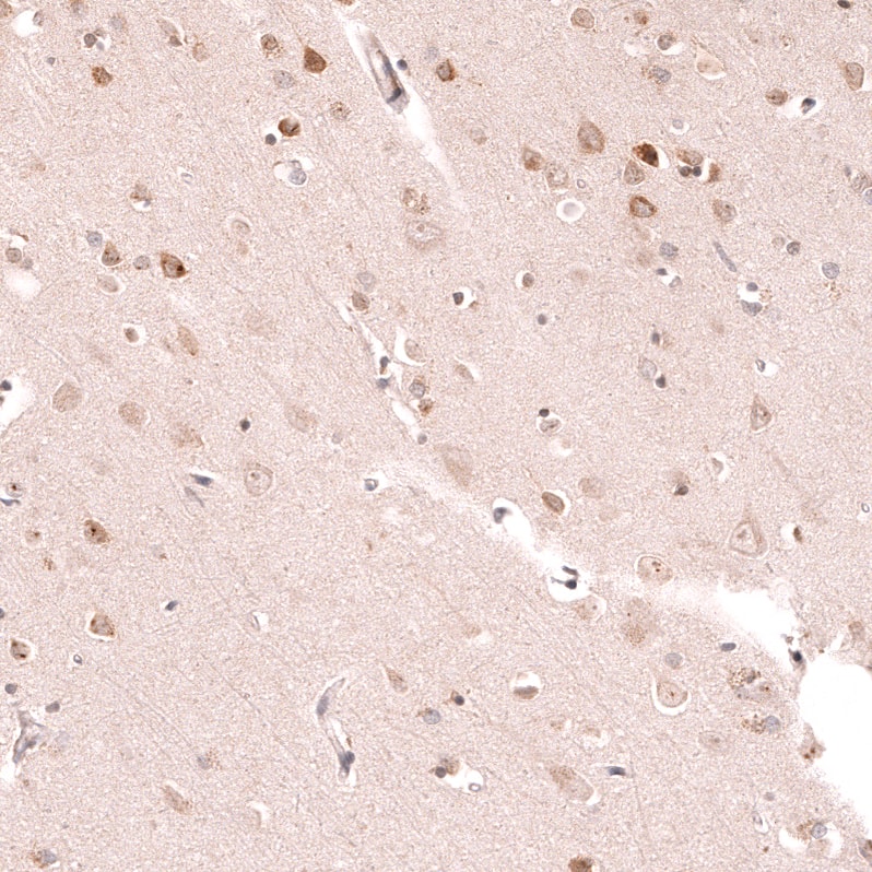 Staining of human cerebral cortex shows weak to moderate cytoplasmic positivity in neurons.