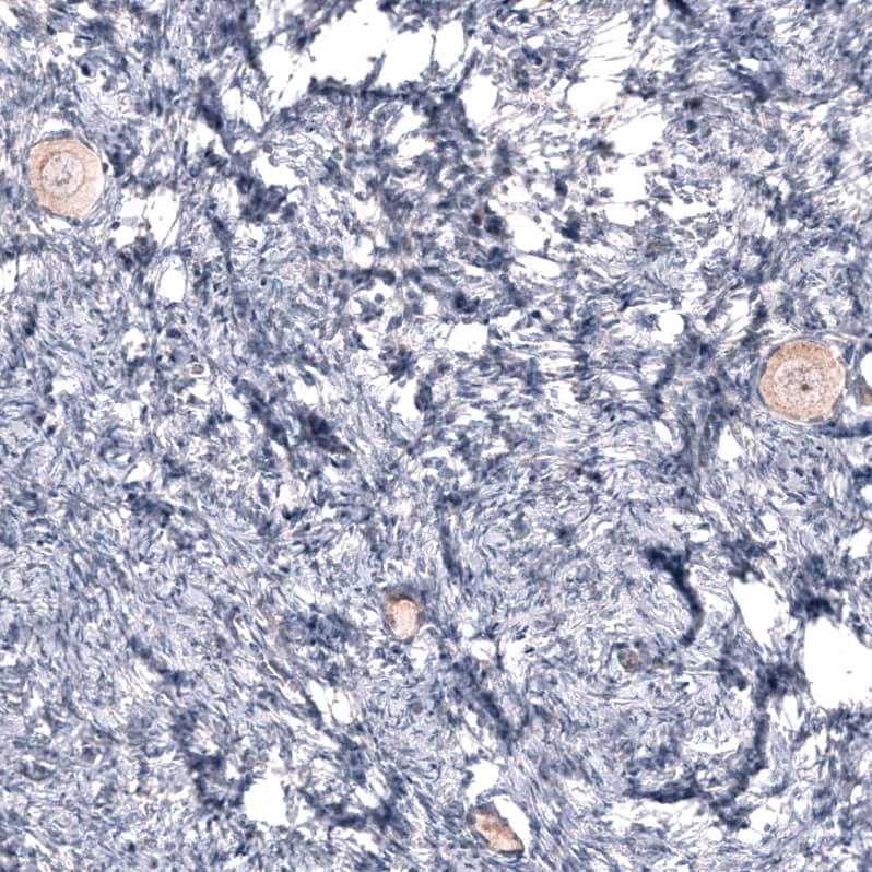 <b>Orthogonal Strategies Validation. </b>Staining of human ovary shows weak to moderate cytoplasmic positivity in oocytes.