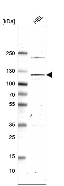 Western blot analysis in human cell line HEL.