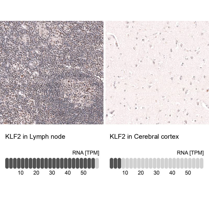 Analysis in human lymph node and cerebral cortex tissues. Corresponding RNA-seq data are presented for the same tissues.